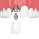 해운대온담치과의원 이미지