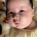 아기 태열 원인 과 관리 및 청대밤 사용후기