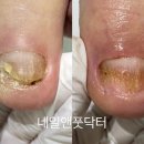 네일앤풋닥터 이미지