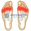 발목, 발, 발가락, 종아리 통증(서울믿음재활의학과) 이미지