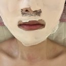 다시 봄 | 청주에스테틱 청주피부관리잘하는곳 산남동 피부관리샵 다시봄 피부관리 후기