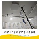 자궁선근증 자궁절제 낭종절제술 강동미즈여성의원 후기