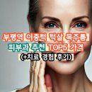 부평역 이중턱 턱살 목주름 제거 피부과 추천 TOP5 가격 (+경험 후기)