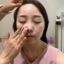 르네드보떼