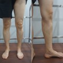 삼성고운맥외과의원 네이버블로그