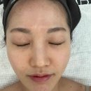 메디칼베드마트 | 봉선동피부관리 수분장벽강화관리로 속건조 해결 더스무스왁싱피부 봉선점