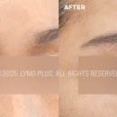 라이모플러스(LYMOPLUS) 이미지