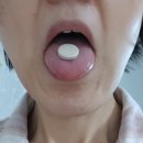 키다리약국 | 먹는 PDRN 리즈네이처 건조한 피부가 촉촉해졌어요.