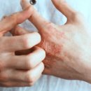 봄바람한의원 이미지