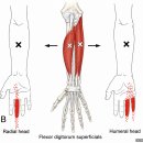 골프엘보·손목·손가락통증이 반복된다면? 전완굴근 Trigger Point를 확인하세요 이미지