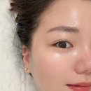용인 동천동피부관리샵 피에스아이뷰티카페 고주파 관리 후기