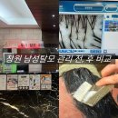 창원기계공구상가 | 창원 탈모관리 닥터포레 2회차 후기 남성 두피관리 변화