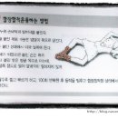 Re:발침이 어려워요. - 순간직침과 산침, 허리통증, 니시운동, 엉덩이주변 통증 이미지