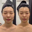 분당정자1-D-1 | 성남 분당 정자역 에스테틱 관리샵 다리아 추천 윤곽축소 솔직후기