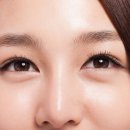 예성정안과의원 이미지