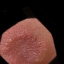 로뎀나무의원 이미지