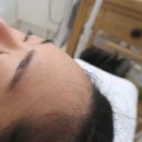분당 클리닉, 리메이크헤어 판교역점 ! 눈썹 + 헤어라인 왁싱 후기