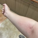 울주군보건소 | 울산 울주군 보건소 산전검사 후기 (예비부모 건강검진 신청방법)