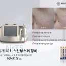 티에스 메디칼 이미지