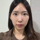 아리랑결혼정보사 | 청담피부과 티타늄리프팅 내돈내산 후기