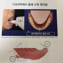 구(고경) | 치과 임상 서적 정리 - ultimate suction denture!