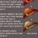 지방간 원인 증세 낫는법 방법 예방 지방간에 좋은음식 이미지