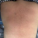 테라피아 | [W16. 예신관리]테라피아 익산점에서 등 필링 관리 받아본 솔직 후기!(협오, 노출주의)