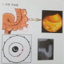 홍채학 강의 나눔-대장과 자율신경 이미지