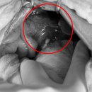 부신메디칼 이미지