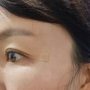 필스톡스의원 | 부산 서면 이마 관자필러, 눈밑 필러, 이마보톡스 리얼시술후기