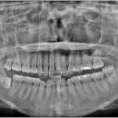 미소가득한치과의원 이미지