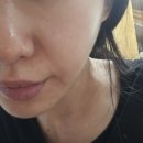 요즘 올영 마스크팩 뭐 사야돼? 잡티+수분 한방에 잡은 메디힐 흔적 리페어 2주 후기