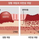 (수정) 중증치유를 돕는 식생활 기초상식...194-2 [ 녹차 & 커피의 역기능성 . 돌팔이와 암치유 . 기타 참고사항 ] 이미지