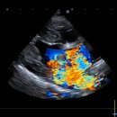 UR(파주시)-[청석로]-상-15 | 강아지 심장병 MMVD와 그로 인한 심원성 폐수종 치료 후기
