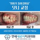 오거리약국 횡단보도 앞 | 덧니 교정 고민? 금광동 치과 단대오거리치과에서 밝은 미소 찾은 리얼 후기! [금광동 교정치과 추천]