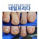 네일프리다 이미지