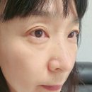 아이존2 PC | 콜라겐세럼&아이크림&브라이트닝크림 추천 "에피엘르" 메이크업클렌저 세안클렌저추천
