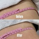 뷰티웰케어 | 안락다이어트 리타임뷰티 복부관리 리얼후기