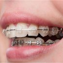 연세바로치과교정과치과의원 이미지