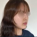 오블리성형외과의원 | 무보형물 코수술 후기와 추천하는 케이스는?