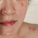 페이버에스테틱 | 야당동 피부관리 수분관리 페이버에스테틱 후기