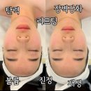 태나 TAENA | 인천 승모근·등관리 잘하는 피부관리샵, 태나뷰티 후기