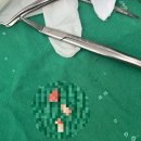 신촌다인치과병원 | [신촌] 잎사귀치과병원 매복 사랑니 발치 후기