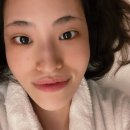 아르케스파 홍대점 | 아르케스파 홍대점 모공타이트닝관리 2차 후기