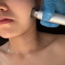 다온스킨 | 연수역 피부관리 다온스킨앤바디 물방울MTS 후기