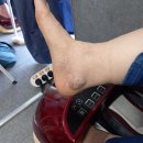 비고르바른건강+고주파 | 비고르바른건강 고주파
