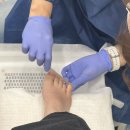 세븐일레븐 평내리치플러스점 | [남양주/호평] 생애 첫 내성발톱 교정 후기 슈블리왁싱&amp;푸스인솔 남양주평내점