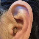 시원한보청기 이미지