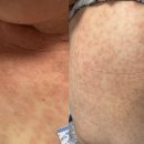 수정반점 이미지