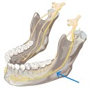 미소진약국 | 목동 사랑니, 발치 통증은 이 정도입니다. (구강악안면외과 전문의 칼럼)